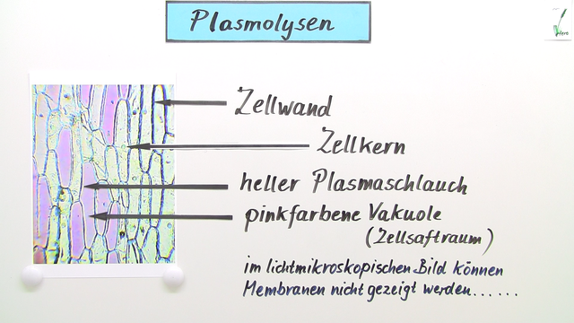 Plasmolyse: Prinzip und Bedeutung – Einfach erklärt